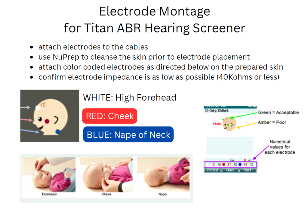 Electrode Montage for Titan ABR Hearing Screener User Guide